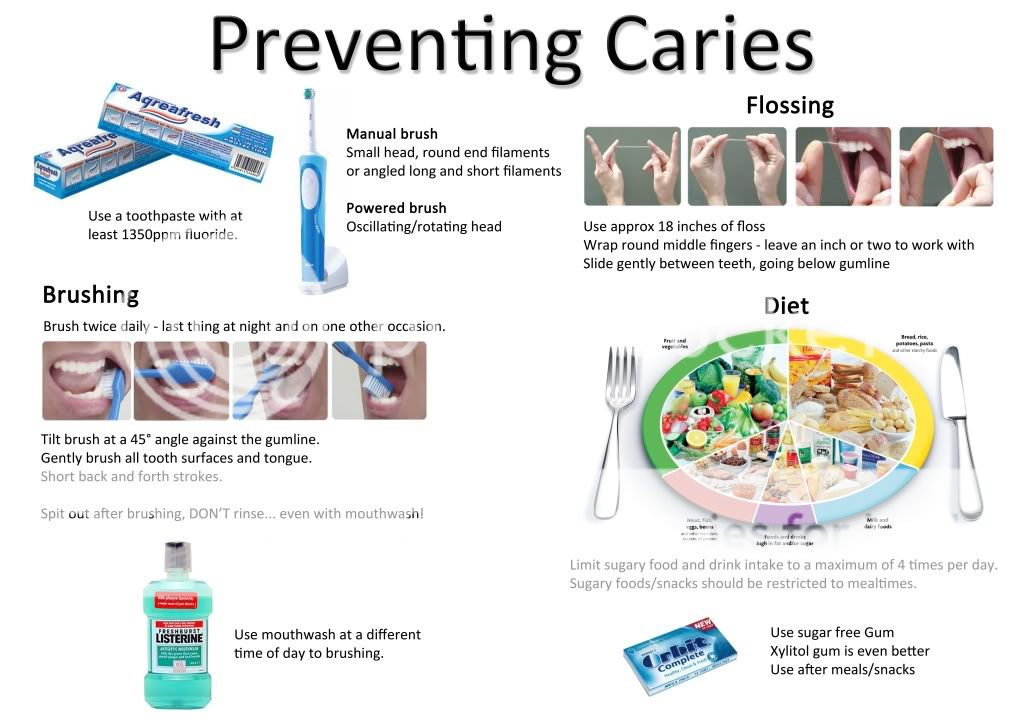 Preventing Caries Photo by UCLan_Dental Photobucket